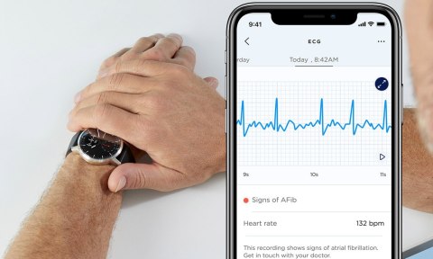Smartwatch Withings ScanWatch 42 mm czarny