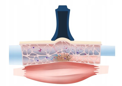 BAŃKA BELLABAMBI MINI MASAŻ PRÓŻNIOWY INTENSE BLUE