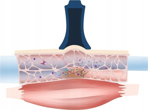 BellaBambi FASZIO zestaw do cuppingu