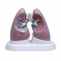Zestaw naukowy 3B Lung z patologiami