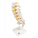 3B Scientific naukowa kolumna kręgosłupa lędźwiowego z wysuniętym dyskiem