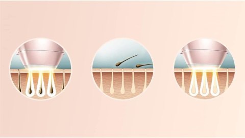 DEPILATOR PHILIPS LUMEA BRI957/00 LASEROWY OKAZJA!